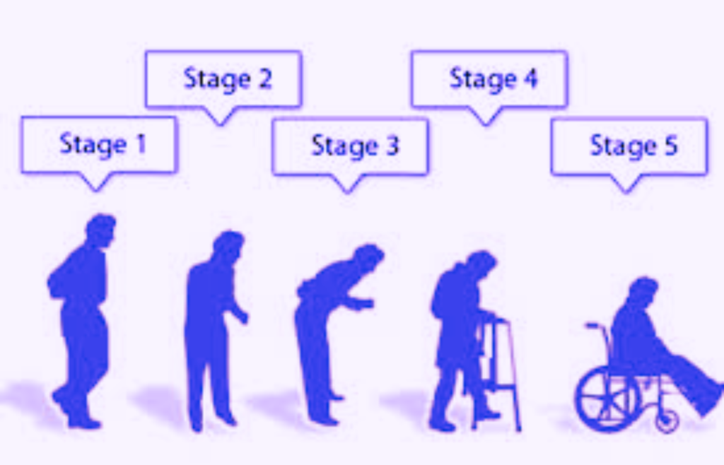 Parkinson Disease কি 2